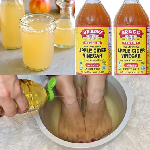 Unlock the Surprising Benefits of an Apple Cider Vinegar Foot Soak: A Natural Remedy for Healthy Feet