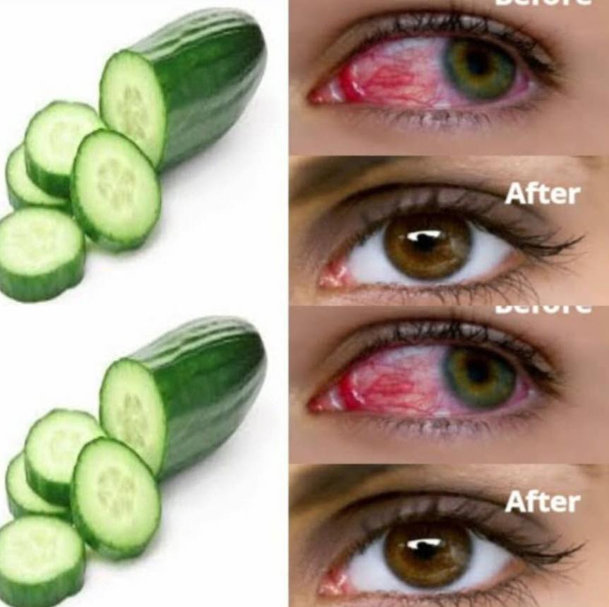 1 tablespoon per day for stronger vision you will see distant objects…See more