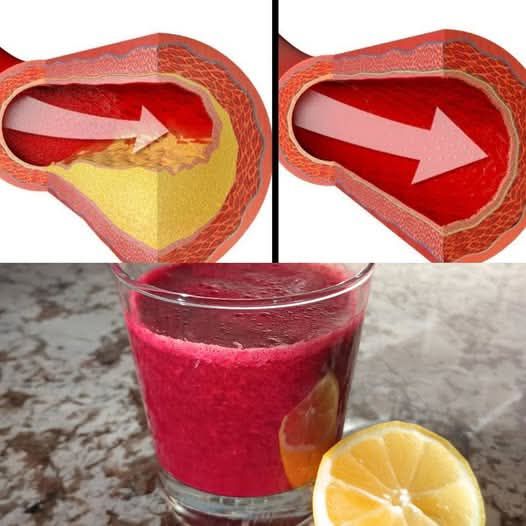 Only A Glass Of This Juice… Reverse Clogged Arteries & Lower High Blood Pressure