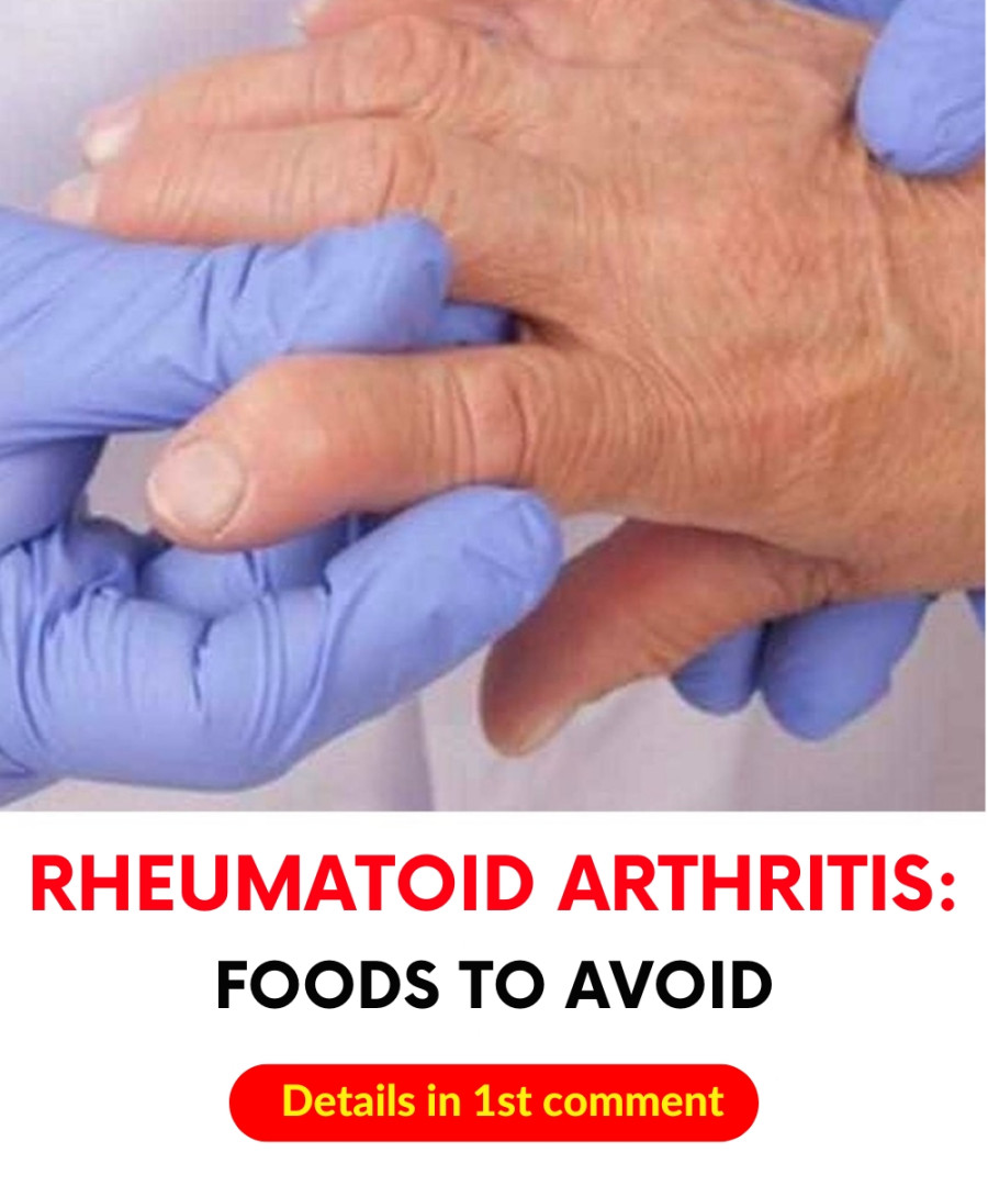 Foods to Avoid When You Have Rheumatoid Arthritis