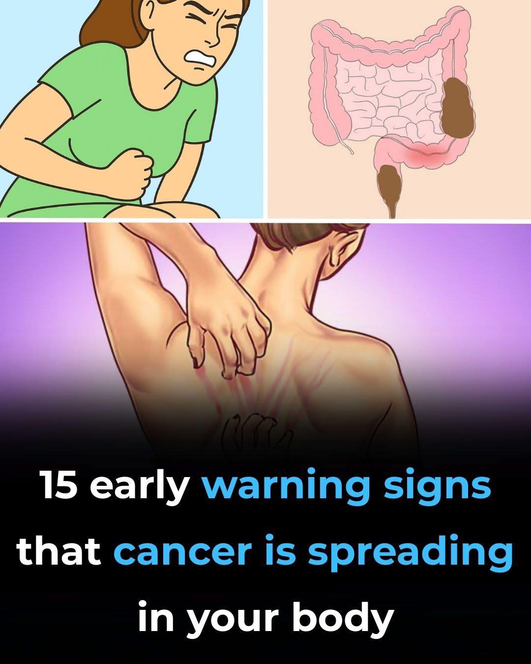 15 Common Warning Signs of Cancer