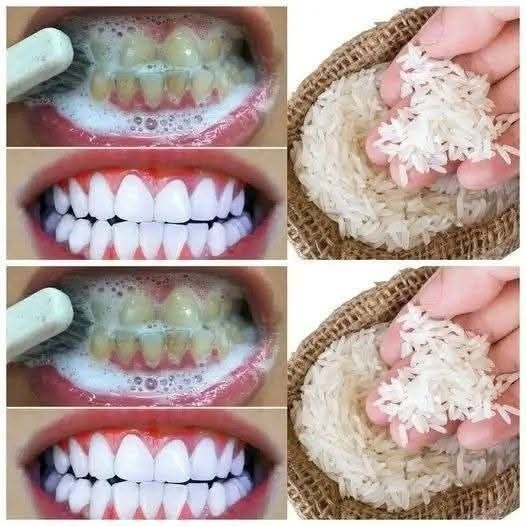 Teeth whitening trick with rice.