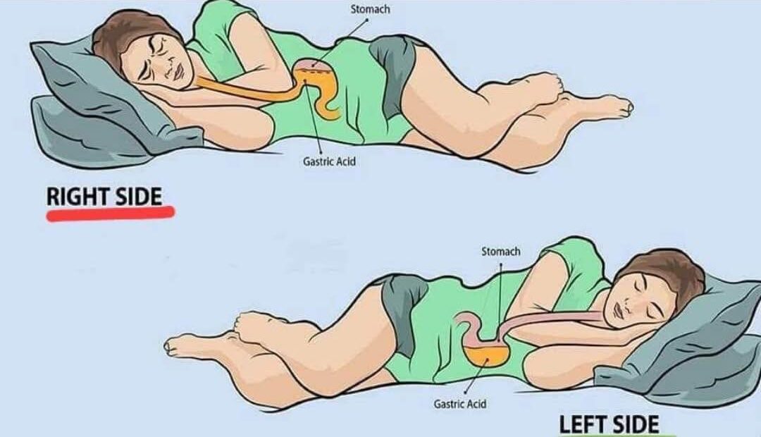 Is Left-Side Sleeping the Secret to Better Health? 