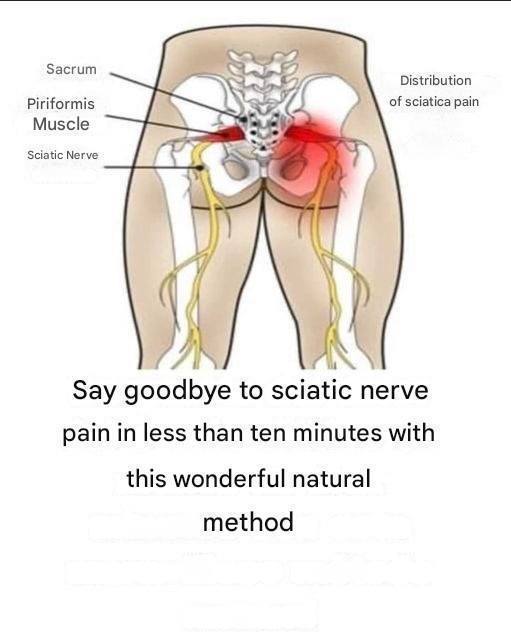 ❌ Say Goodbye to Sciatic Nerve Pain in Less Than Ten Minutes with This Wonderful Natural Method
