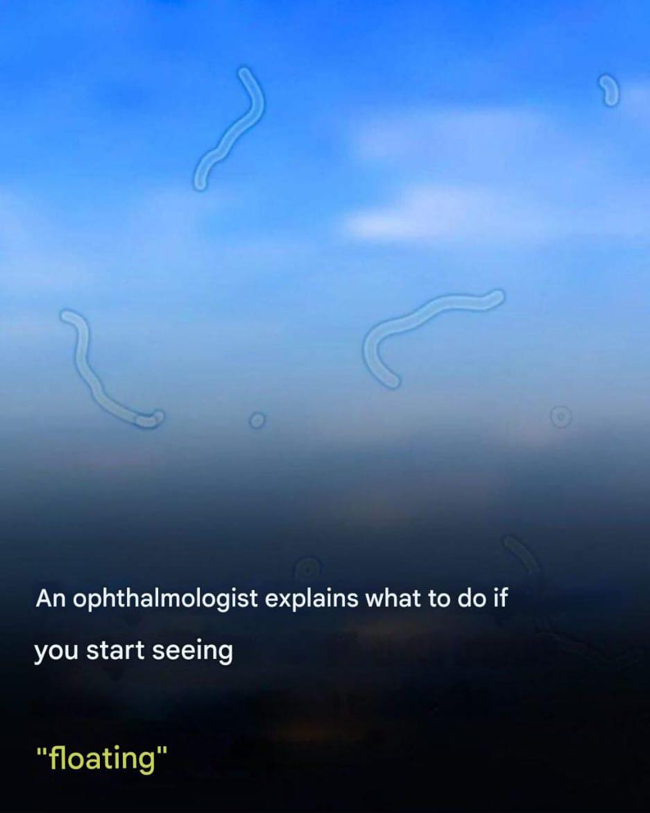What are floaters? Here’s what you should do if you see them.