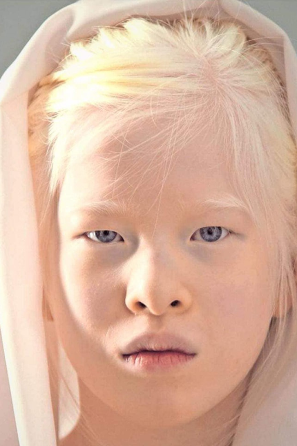 “From Abandonment to Vogue: The Remarkable Journey of Xueli Abbing, the Girl Born ‘Too Different’”