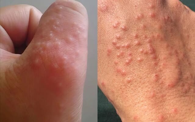 Don’t overlook these small red spots on your arm – They could be important w.arning signs