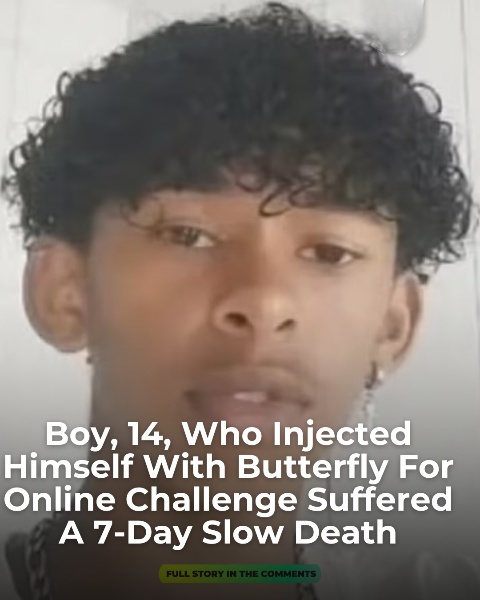 Boy, 14, who injected himself with butterfly for online challenge suffered a 7-day slow death!
