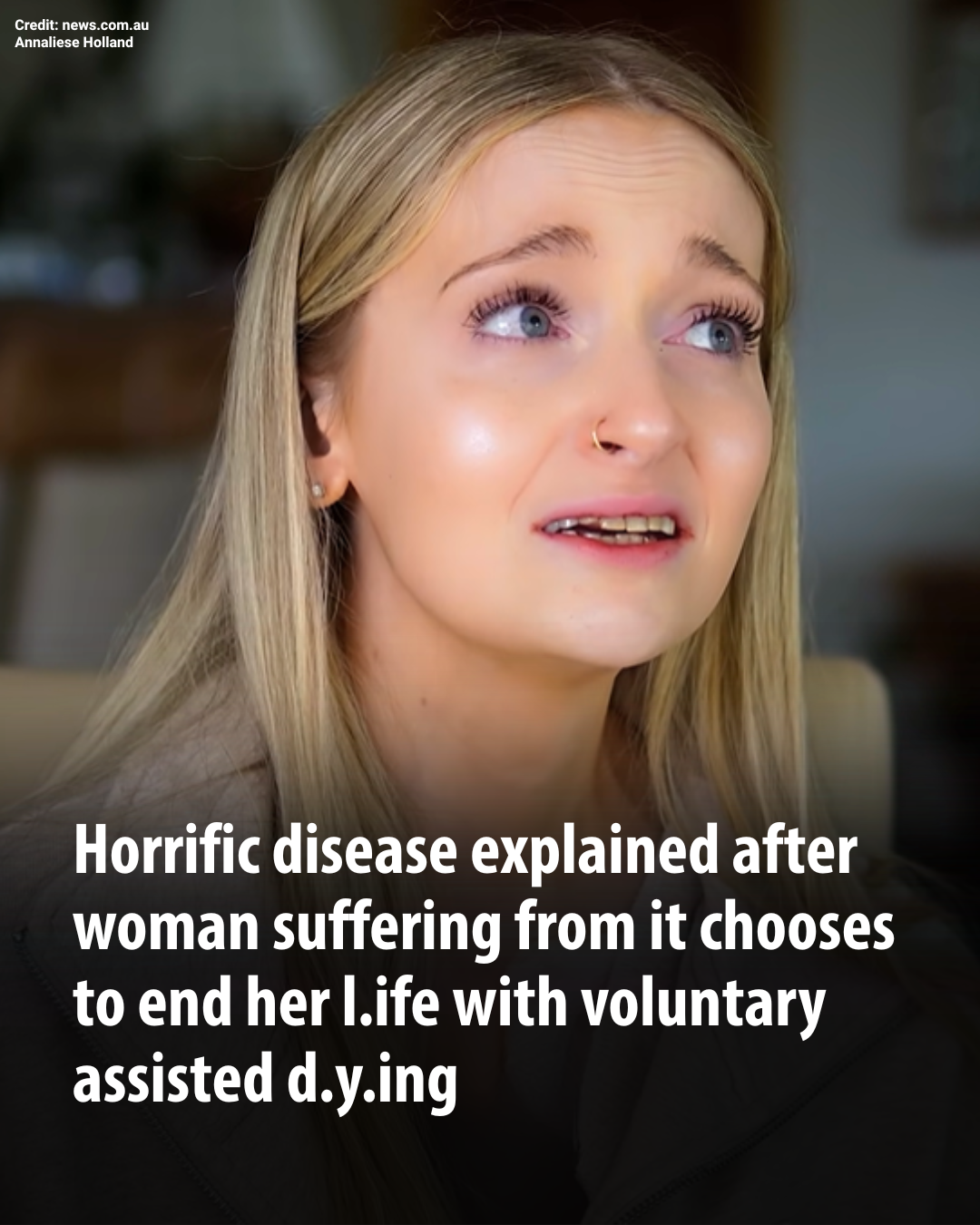 Living With a Rare Condition, a 25-Year-Old Faces One of Life’s Hardest Decisions