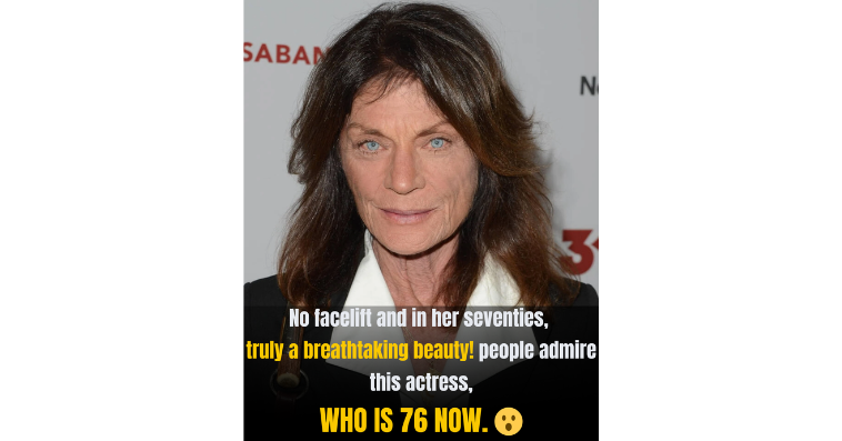 A Familiar Face, Almost Unrecognizable