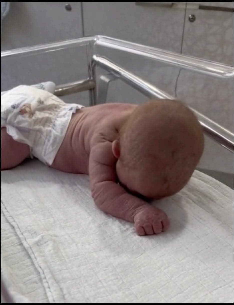 Baby born with an DIU peg – See now! – Story Of The Day!